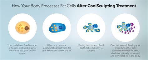 Top CoolSculpting Providers in Saint Louis, MO .
